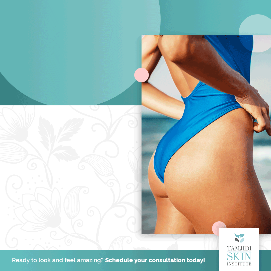 QWO-Cellulite-Treatments-infographic