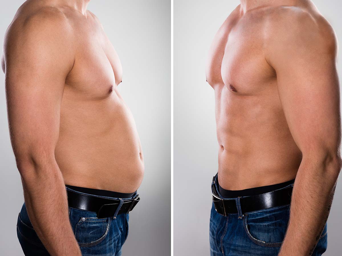 1200x900GMB-1-emsculpt Before and after photo of man with defined ab muscles