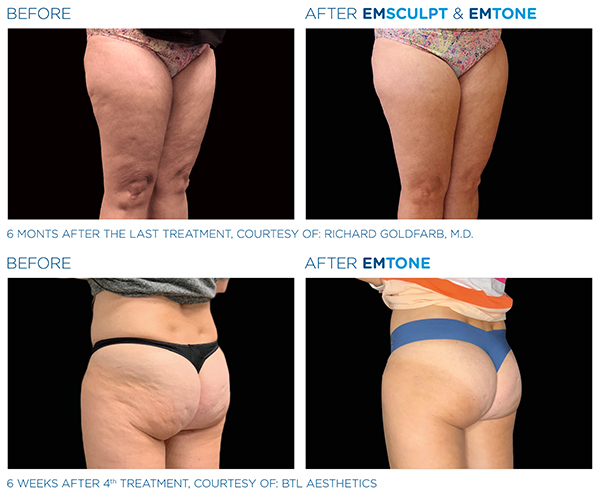 beforeafter2