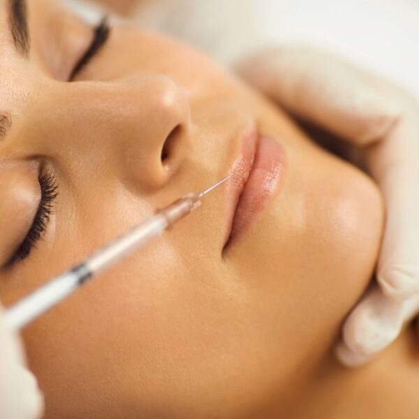botox treatment