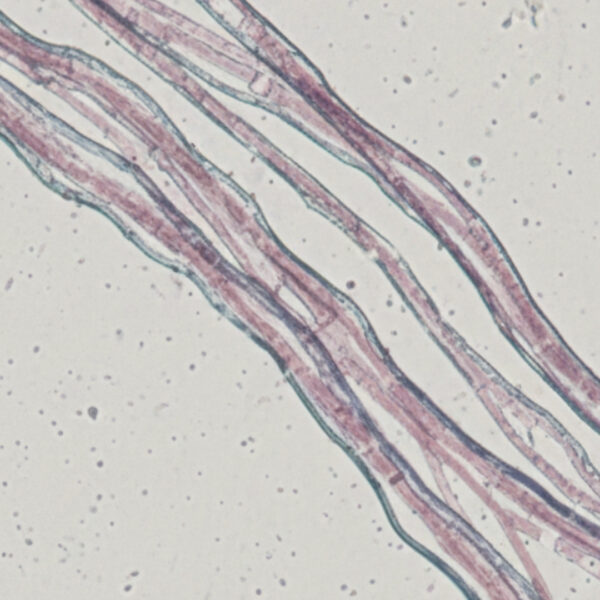 Microscopic view of collagen fibers intertwined