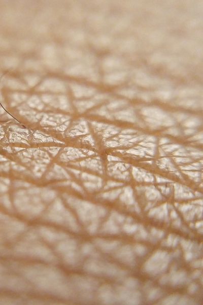 skin laxity A macro photograph of the skin's surface, highlighting a "crinkled" or "cross-hatched" texture. The image shows a loss of firmness and the detailed pattern of fine dehydration lines or age-related laxity.