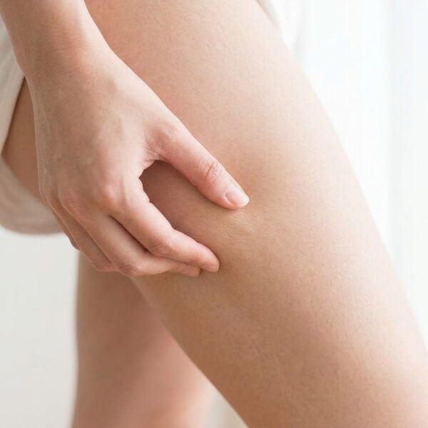 A soft photograph focusing on a hand gently pinching the skin on an upper thigh, demonstrating tissue structural integrity.