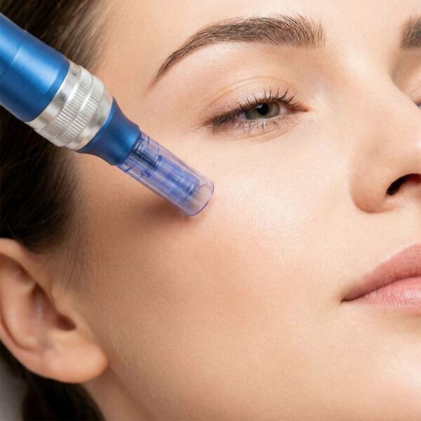 A high-tech medical microneedling device being applied gently to smooth facial skin during a clinical treatment.